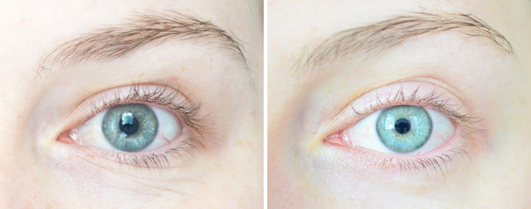 contour-des-yeux-whitening-anti-rides-whamisa-organic-flowers-eye-essence-avant-apres